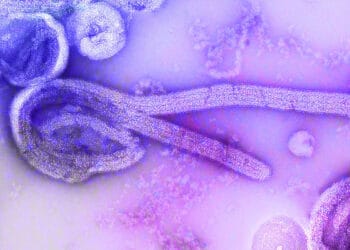 electron microscopic image of the 1976 isolate of Ebola virus