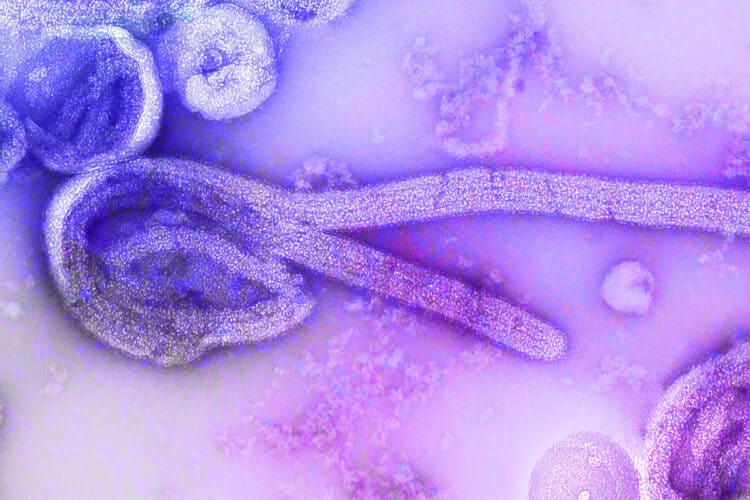 electron microscopic image of the 1976 isolate of Ebola virus